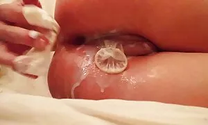 hd වලින් ශුක්‍රාණු ස ...